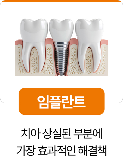 디디치과 임플란트 치아 상실 부위 해결