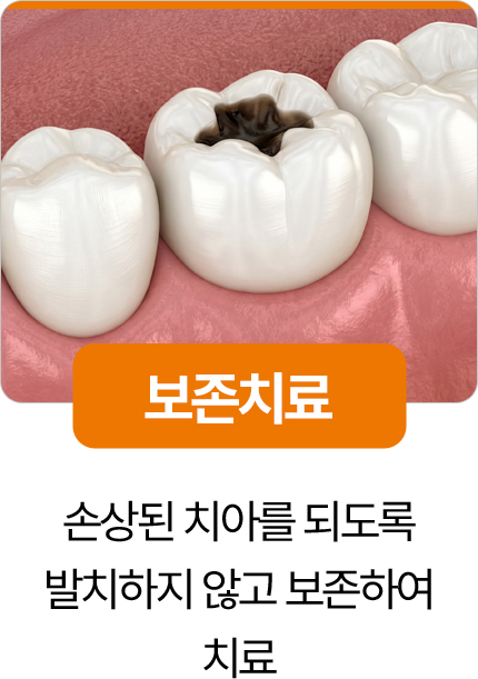 디디치과 보존치료 손상 치아 보존
