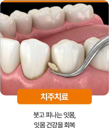 디디치과 치주치료 잇몸 건강 회복
